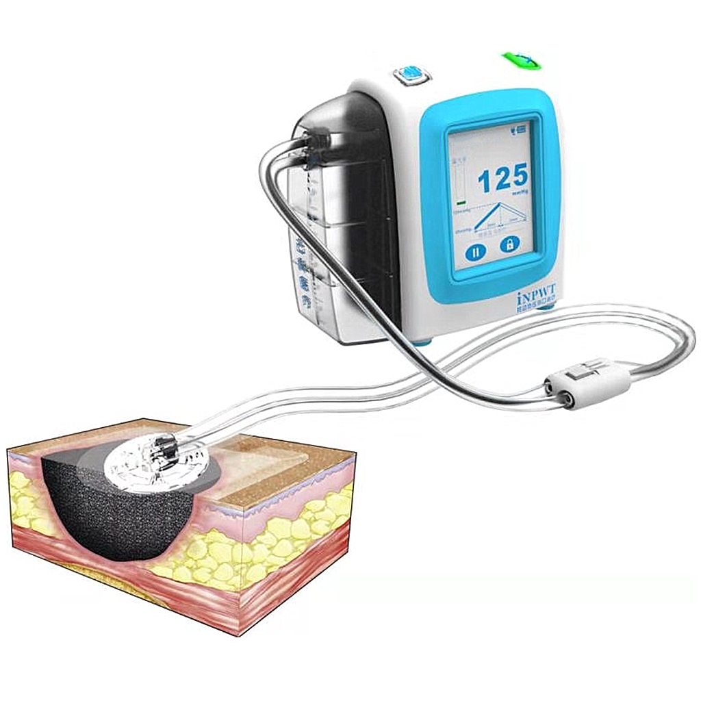NPWT device connected to a dressing system