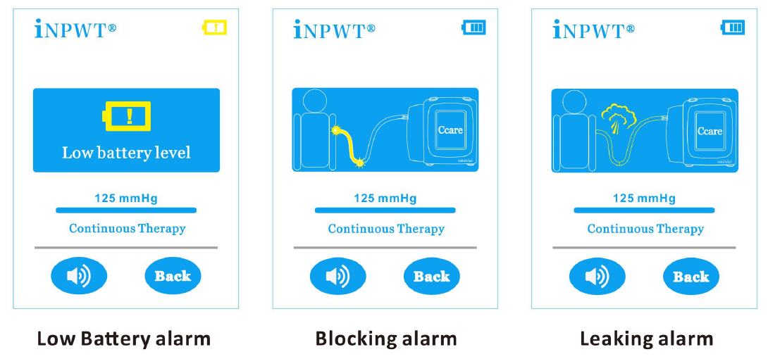 iNPWT low battery, blocking and leaking alarm screens