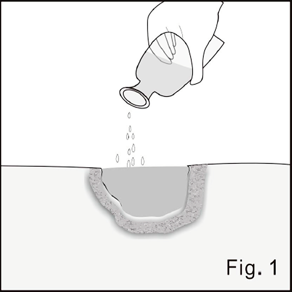 Wound preparation illustrated in source figure 1