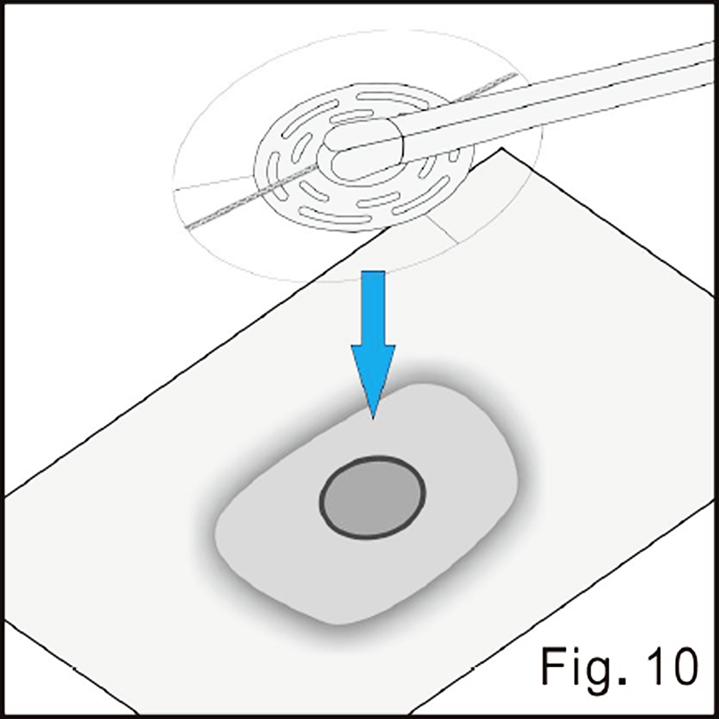 Align the tubing pad illustrated in source figure 10