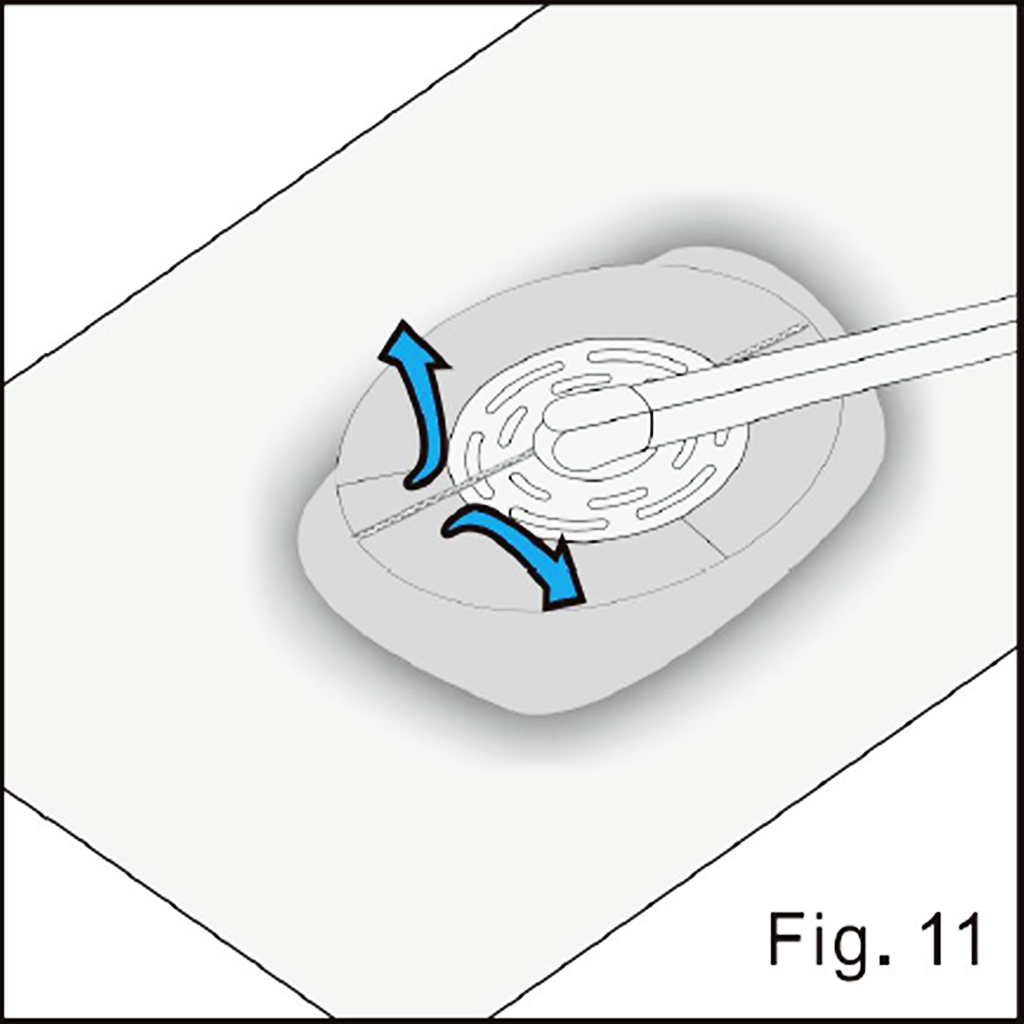 Remove the pad carrier illustrated in source figure 11