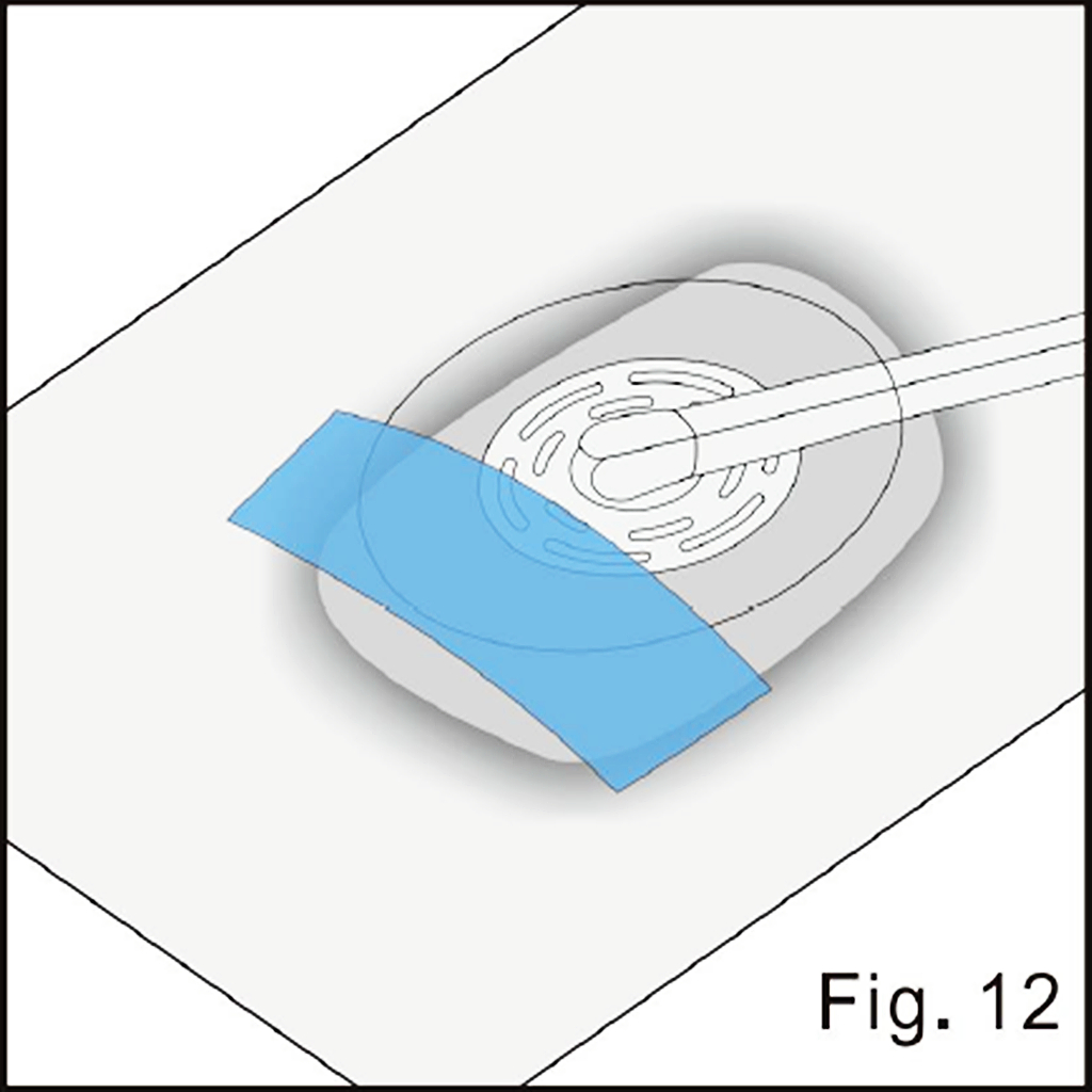 Begin pad stabilization illustrated in source figure 12
