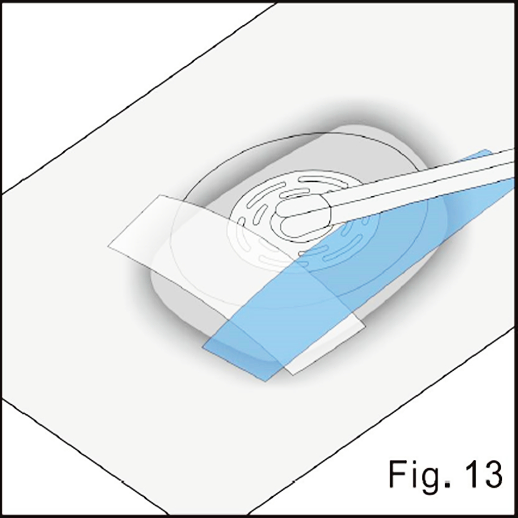 Continue stabilization illustrated in source figure 13