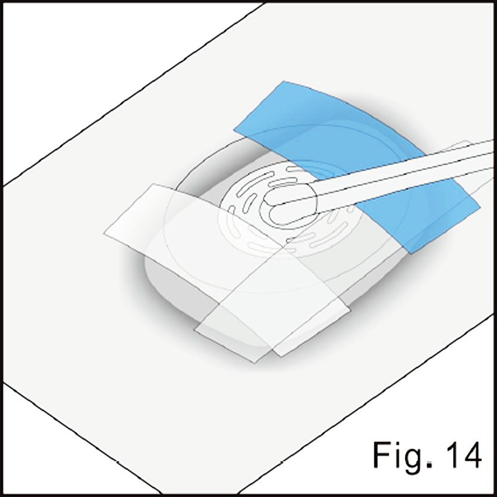 Complete the film overlap illustrated in source figure 14