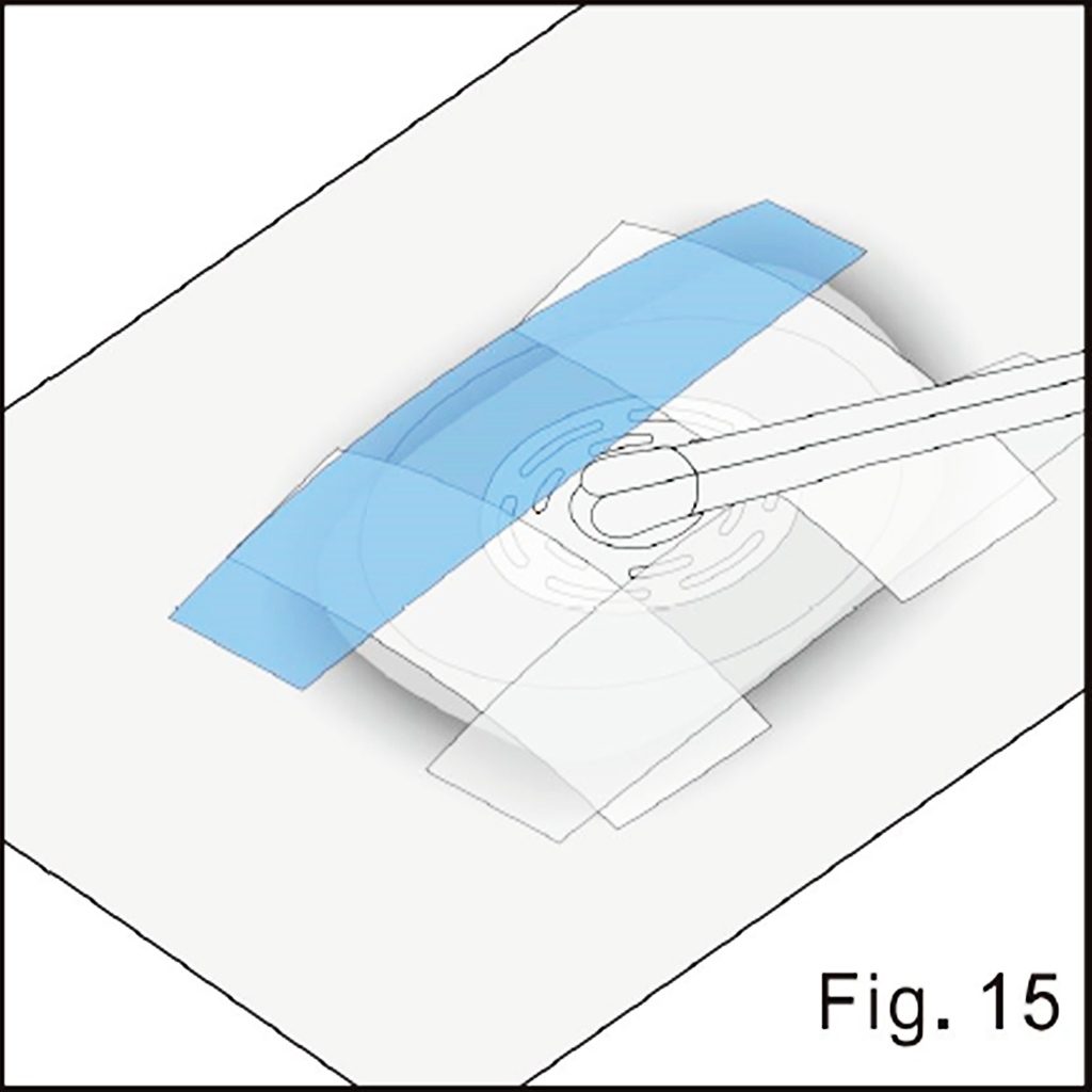 Finish the pad seal illustrated in source figure 15