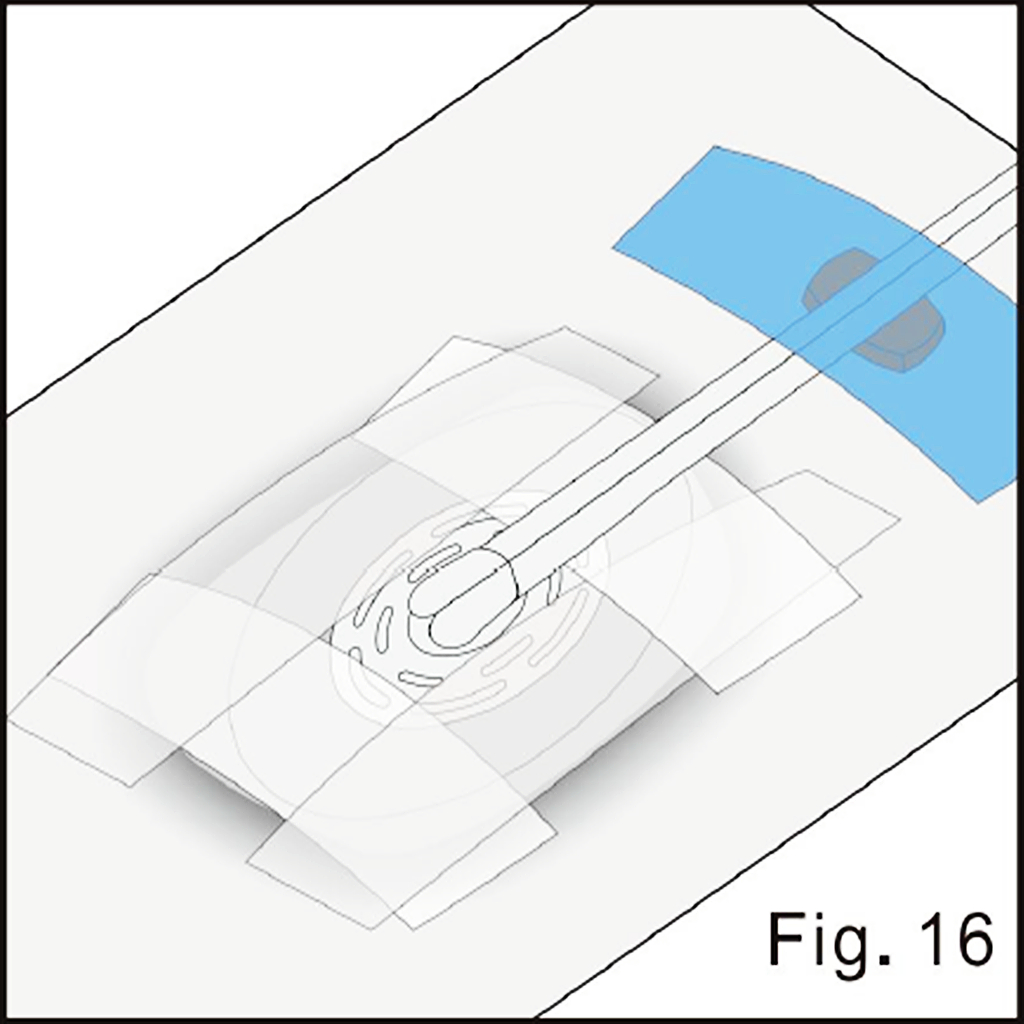 Secure the tubing illustrated in source figure 16