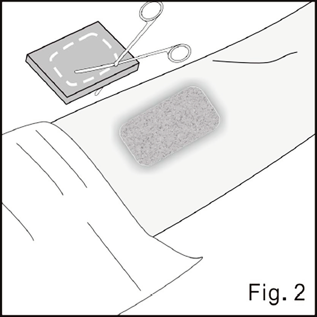 Size and shape the foam illustrated in source figure 2