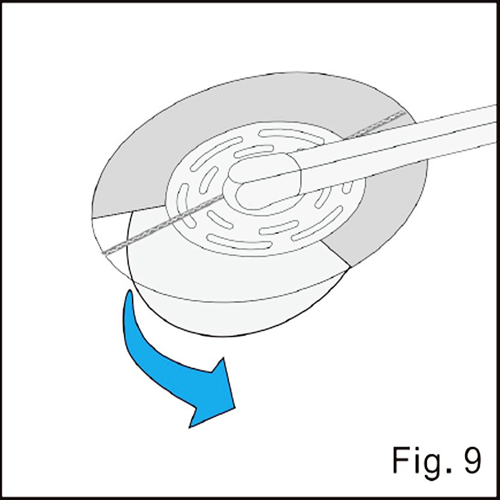 Remove the pad backing illustrated in source figure 9