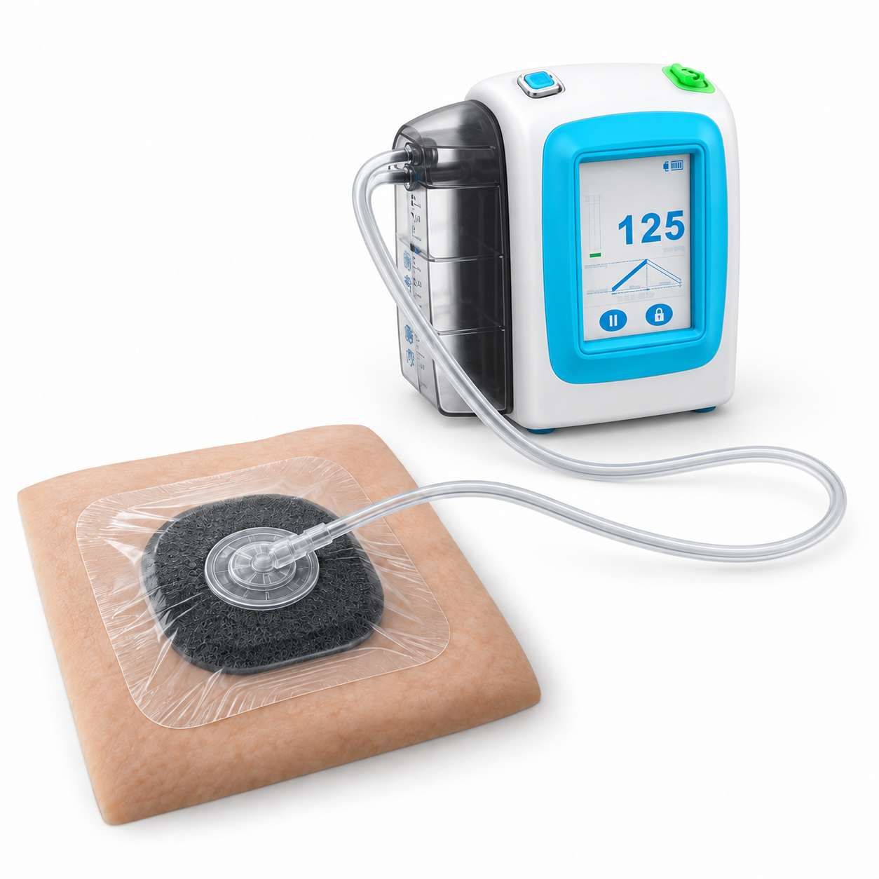 iNPWT therapy unit connected to a sealed dressing system